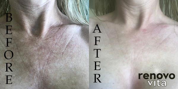 Results are What Count – Virg-N Youth Serum Delivers
