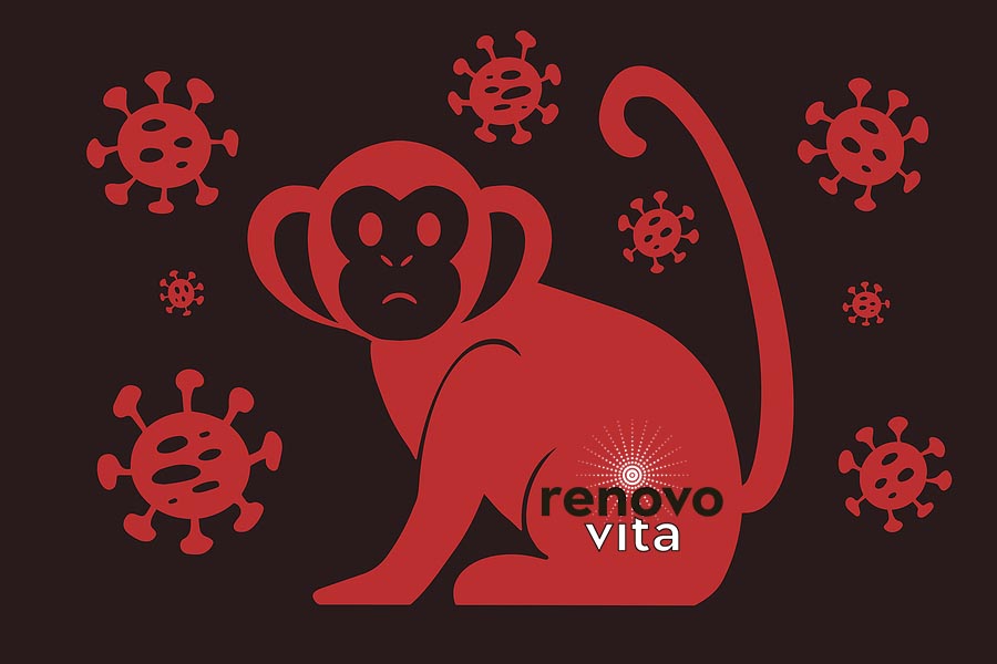 Monkey Pox- Boost Your Immune System and Be Proactive About Protecting Your Health